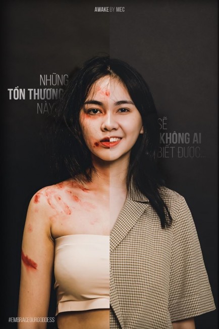 Khám cho trẻ bị viêm họng.