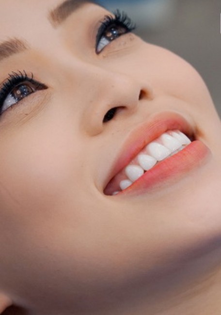 Làm đẹp răng là nhu cầu của nhiều người.