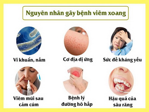 Viêm mũi xoang dị ứng gia tăng do môi trường