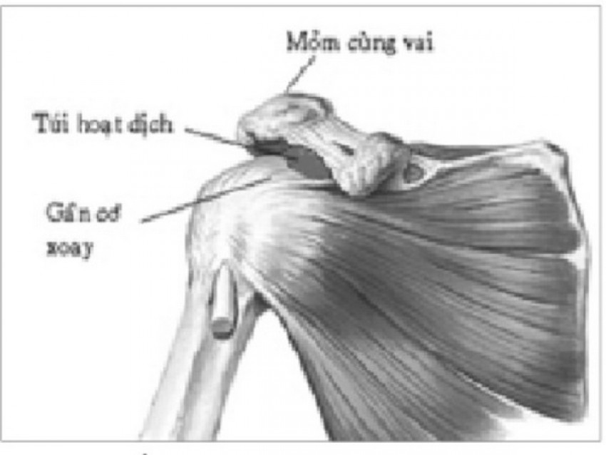Nhược cơ là bệnh lý thần kinh cơ mạn tính.