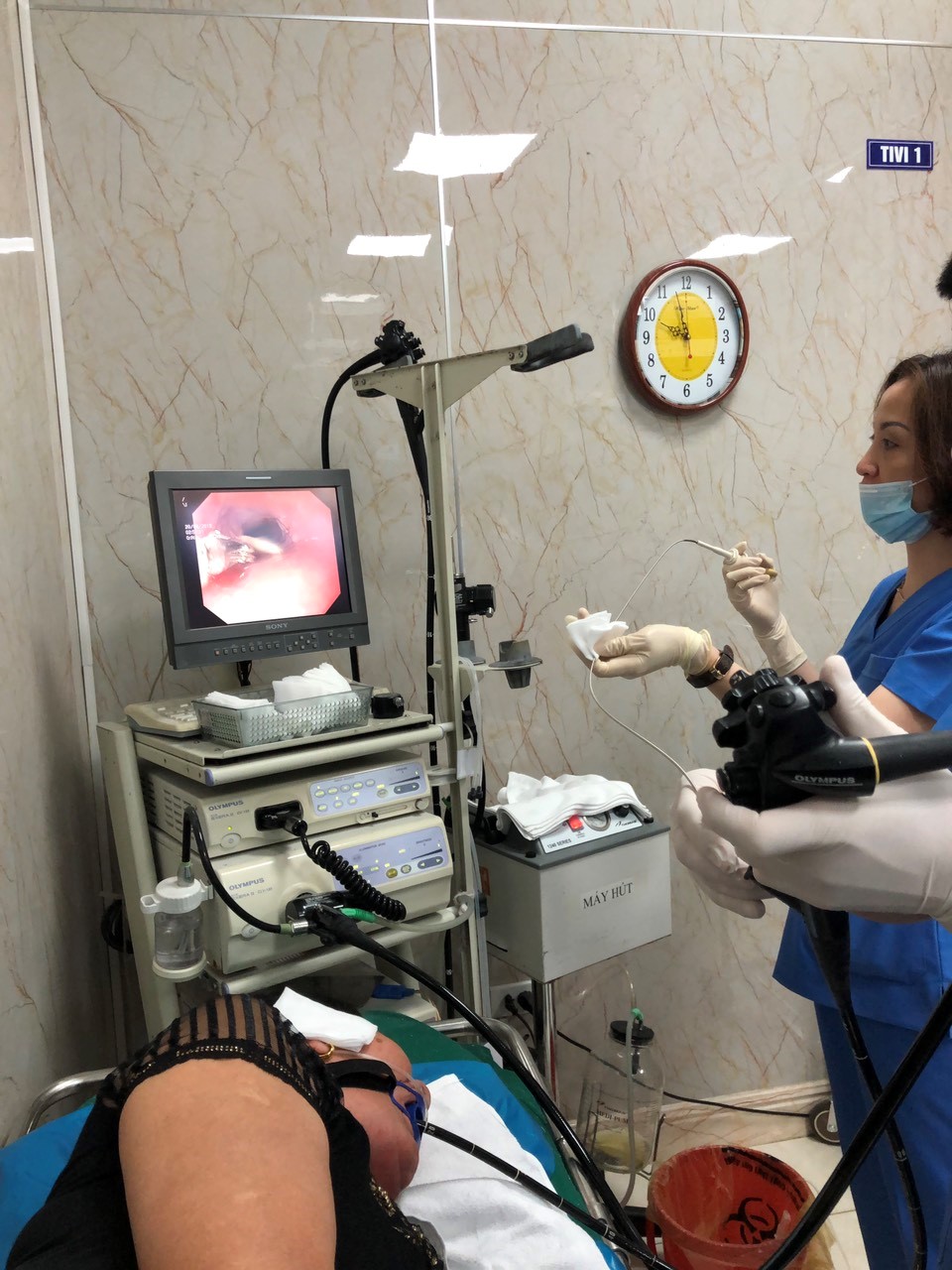 Bệnh viện TWQĐ 108: Xử lý gắp xương gà mắc sâu trong thực quản.