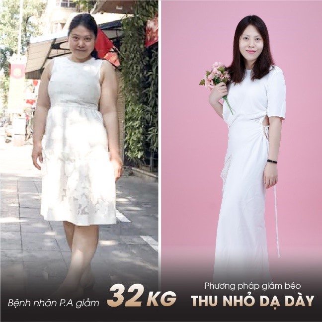 "Phẫu thuật nội soi thu nhỏ dạ dày - nơi khởi nguồn cuộc sống mới"