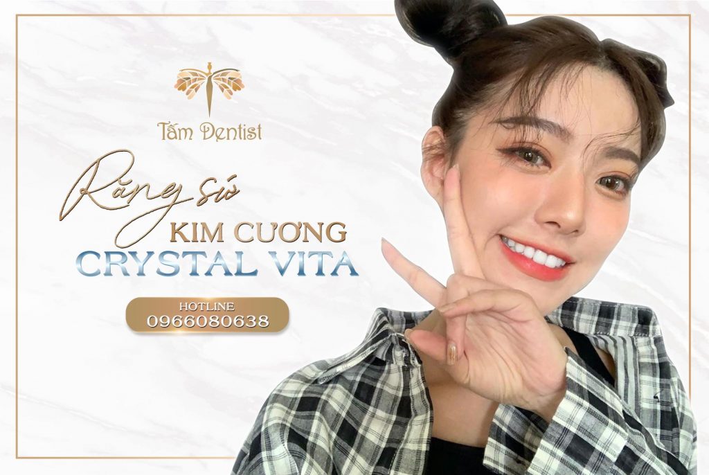 Bọc răng sứ Kim Cương Crystal Vita – Đẳng cấp vợt trội