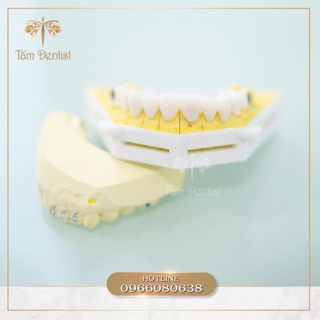 Răng sứ Zirconia