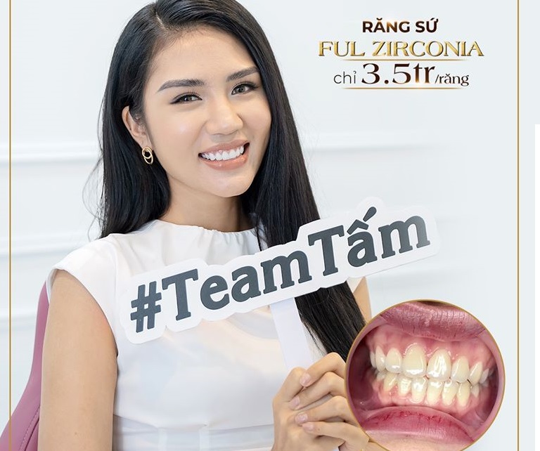 Bọc sứ thẩm mỹ Zirconia – Khắc phục hàm hô móm, răng thưa, sứt mẻ