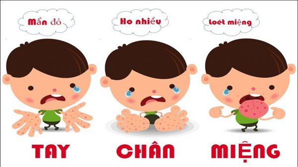 Ngừa biến chứng bệnh tay chân miệng