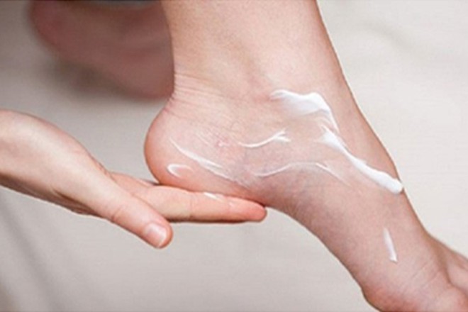 5 lời khuyên giúp kiểm soát bệnh vẩy nến ở chân