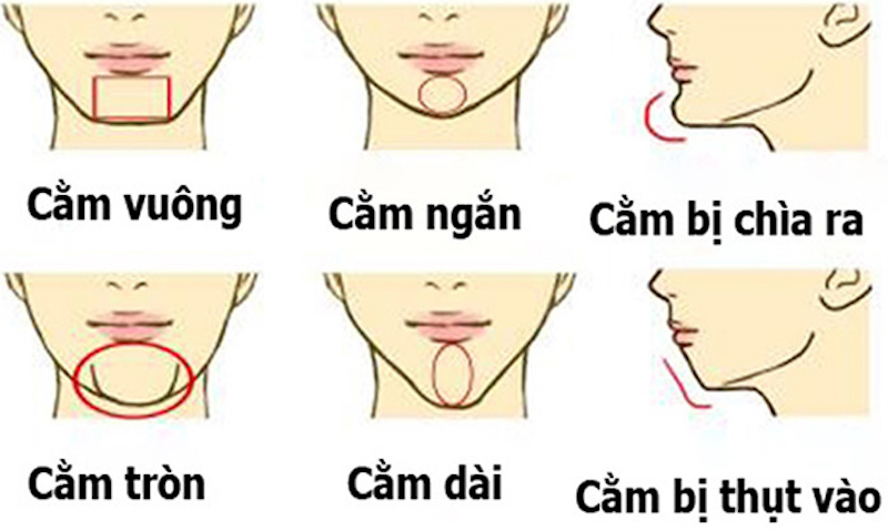 Cằm vuông là gì và cách khắc phục cằm vuông hiệu quả
