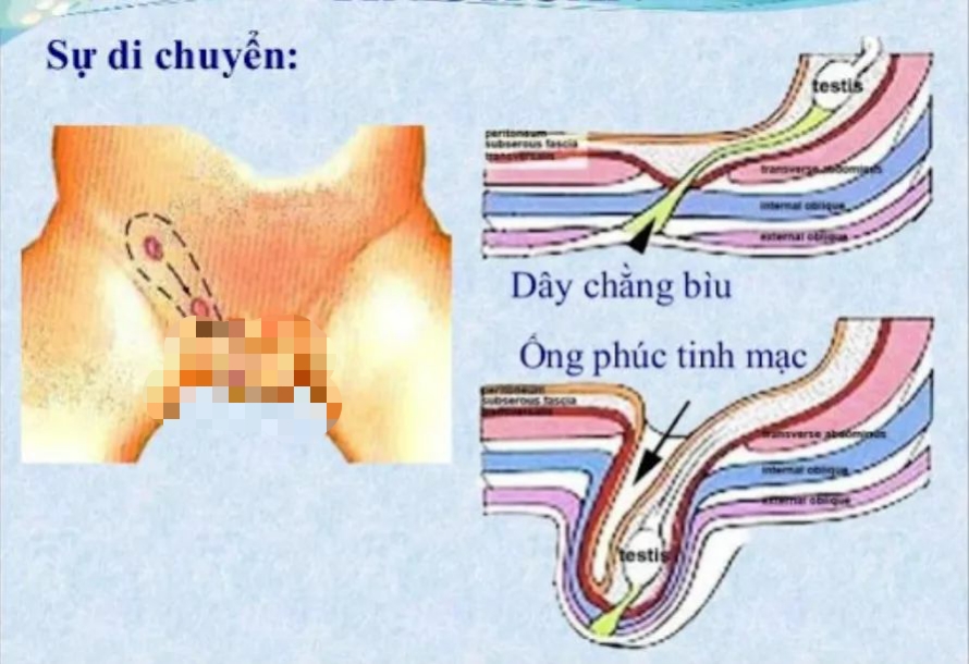 Căn bệnh nguy hiểm cứ 100 trẻ thì có đến 5 trẻ mắc, cha mẹ lại dễ bỏ qua