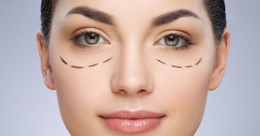 thẩm mỹ mắt uý tín