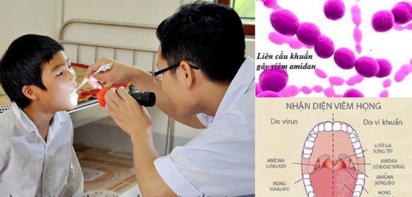 Khám cho trẻ bị viêm họng.