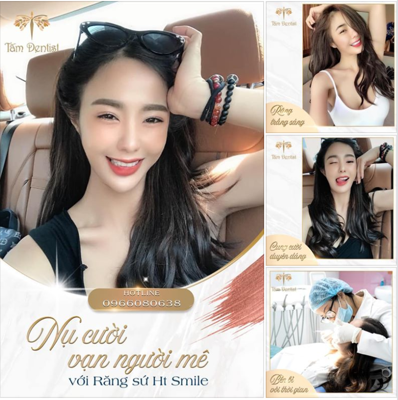 Nụ cười rạng rỡ với Bọc răng sứ HT Smile – Xu hướng làm đẹp 2020