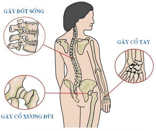 Món ăn cải thiện loãng xương