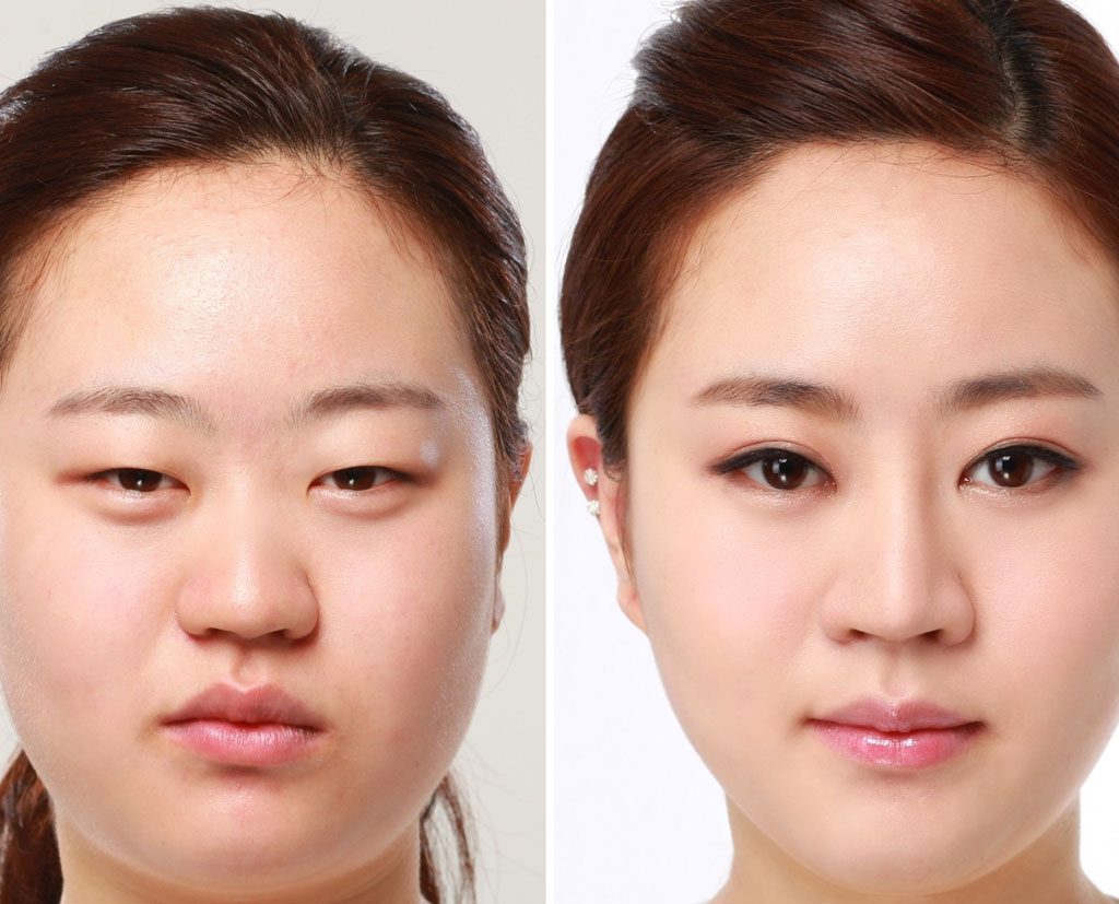 Bỏ túi kinh nghiệm phun mí mắt đẹp từ A đến Z