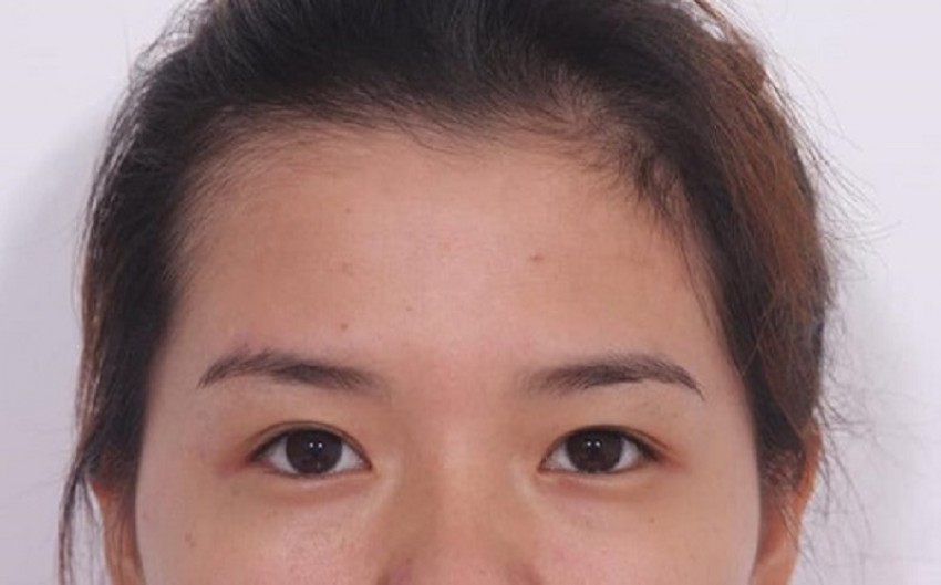 dáng mắt cụp