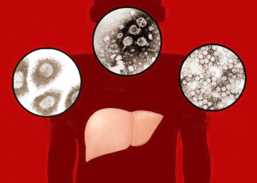 Có nhiều loại virus gây viêm gan.