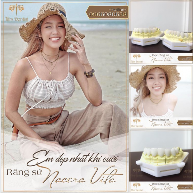 Dán sứ Nacera Vita