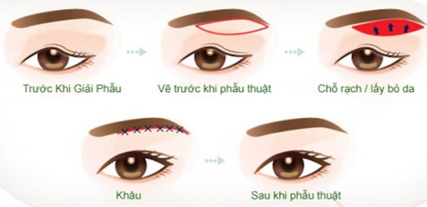 quy trình thực hiện