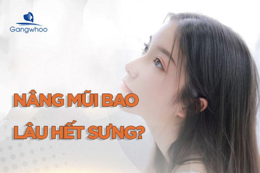 Nâng mũi bao lâu thì hết sưng?
