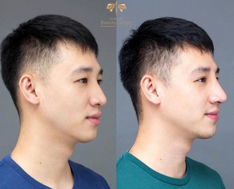 Nang Mui hàn quốc