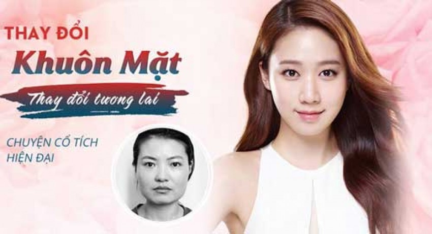 Nâng Mũi Có Thay Đổi Khuôn Mặt Không?