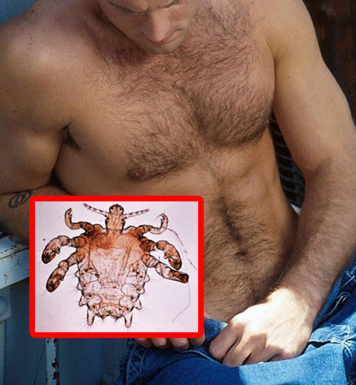 Những căn bệnh làm quý ông ngứa điên