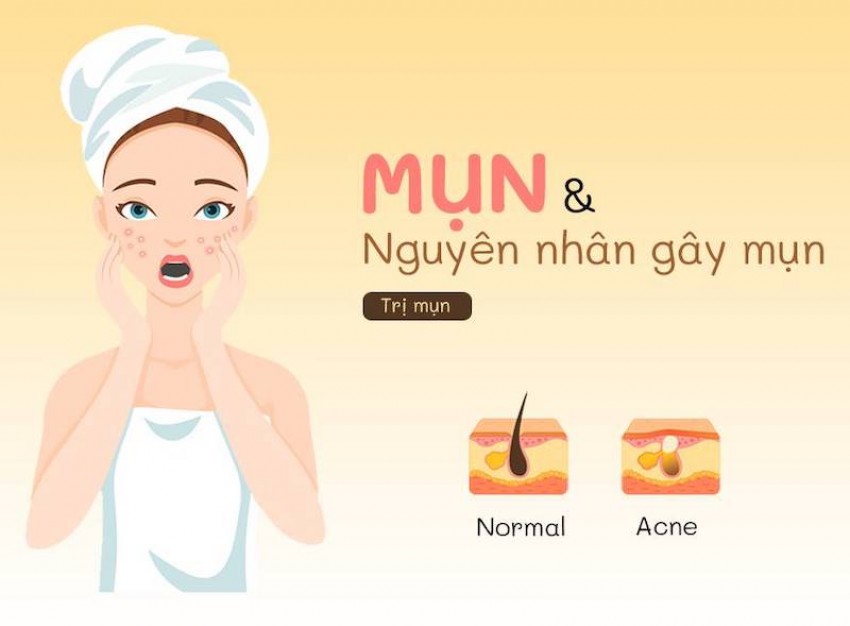trị mụn