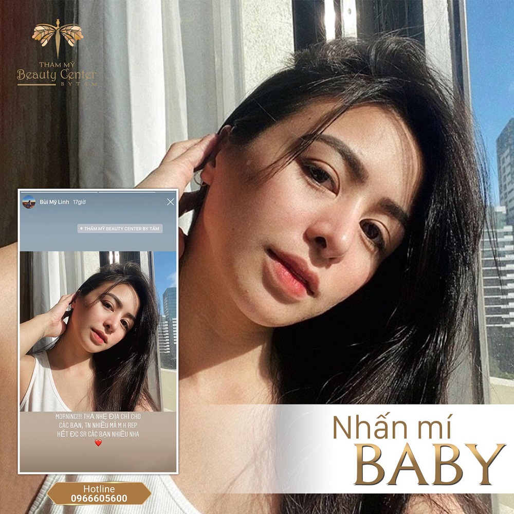 Nhấn mí là gì? Phân biệt cắt mí, nhấn mí, bấm mí