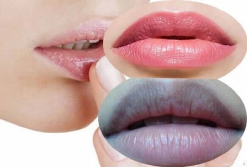 Phun môi trị thâm – Đánh bật môi thâm nhanh và triệt để