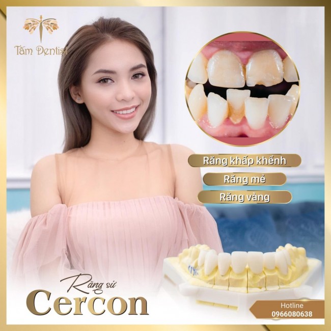 Rang Su Cercon