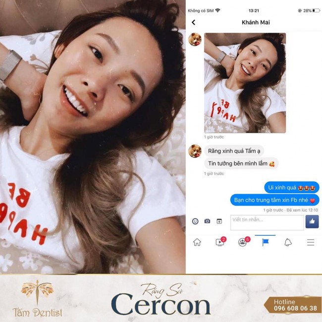 Rang Su Cercon Dep