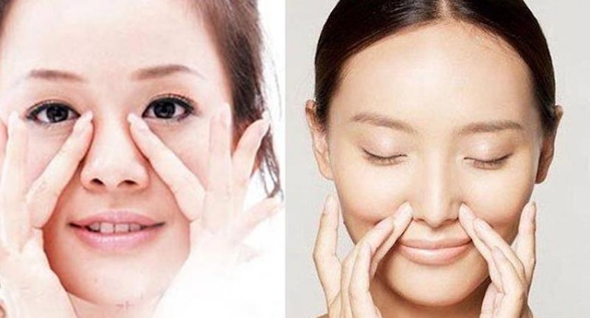 thu gọn cánh mũi không phẫu