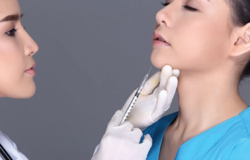 filler cằm