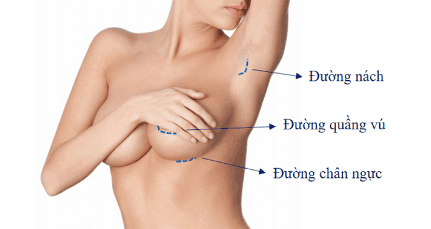 Top 5 Bệnh Viện Thẩm Mỹ Nâng Ngực Đẹp Và An Toàn Tại TPHCM