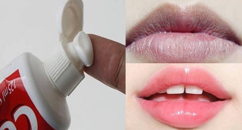 Trị thâm môi bằng kem đánh răng có hiệu quả không? Làm như thế nào?