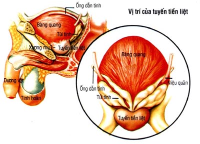 Bệnh tuyến tiền liệt – chớ coi thường!