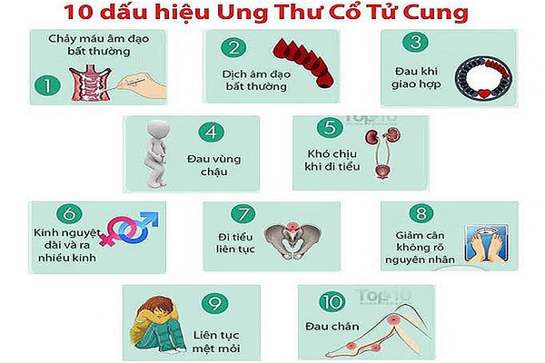Nhận biết ung thư cổ tử cung giai đoạn sớm