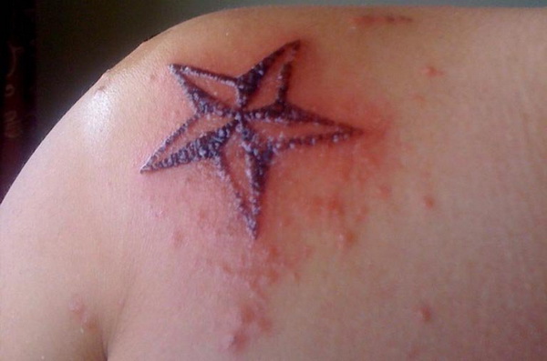 Những bệnh dễ mắc do phun xăm