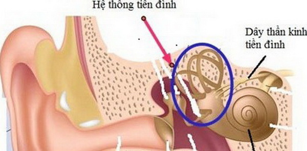Đối phó chứng rối loạn tiền đình