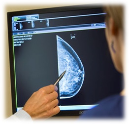 Ung thư vú- Những điều cần biết để phát hiện sớm