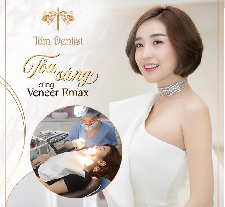 Dán sứ Veneer Emax và tác dụng của mặt dán sứ thẩm mỹ của răng