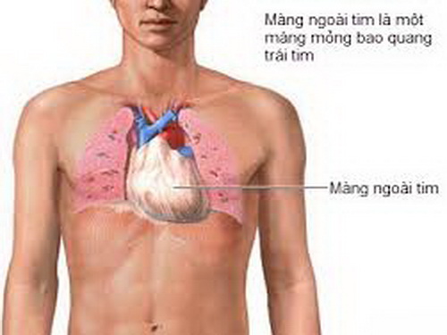 Viêm màng ngoài tim co thắt nguy hiểm thế nào?